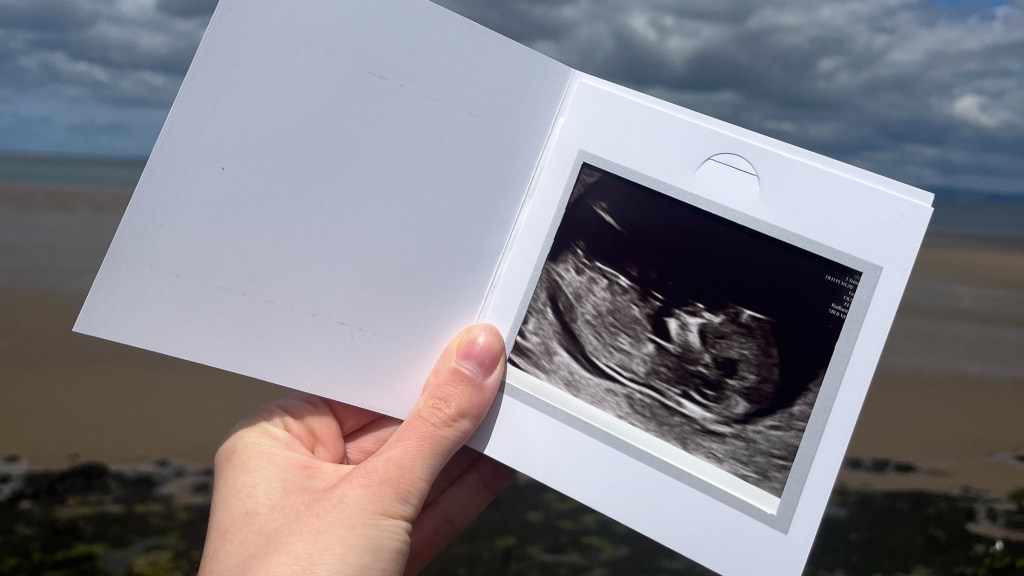 Kuidas ma emakavälise raseduse hirmus kodus vikatimeest&nbsp;ootasin